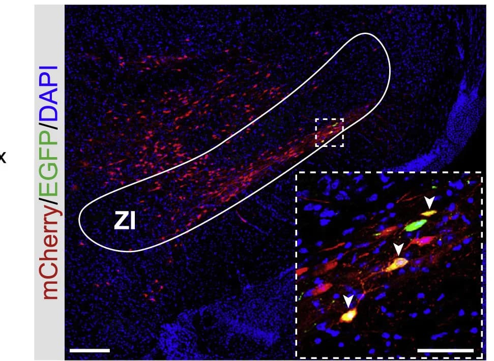Open access visualization of Microscopy, Starter Cells, Presynaptic Cells, Non-Starter Cells, ZI