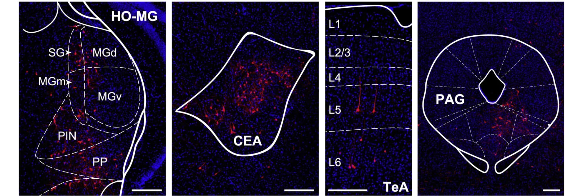 Open access visualization of Microscopy, Presynaptic Neurons, Auditory Thalamus, Central Amygdala, Temporal Association Cortex