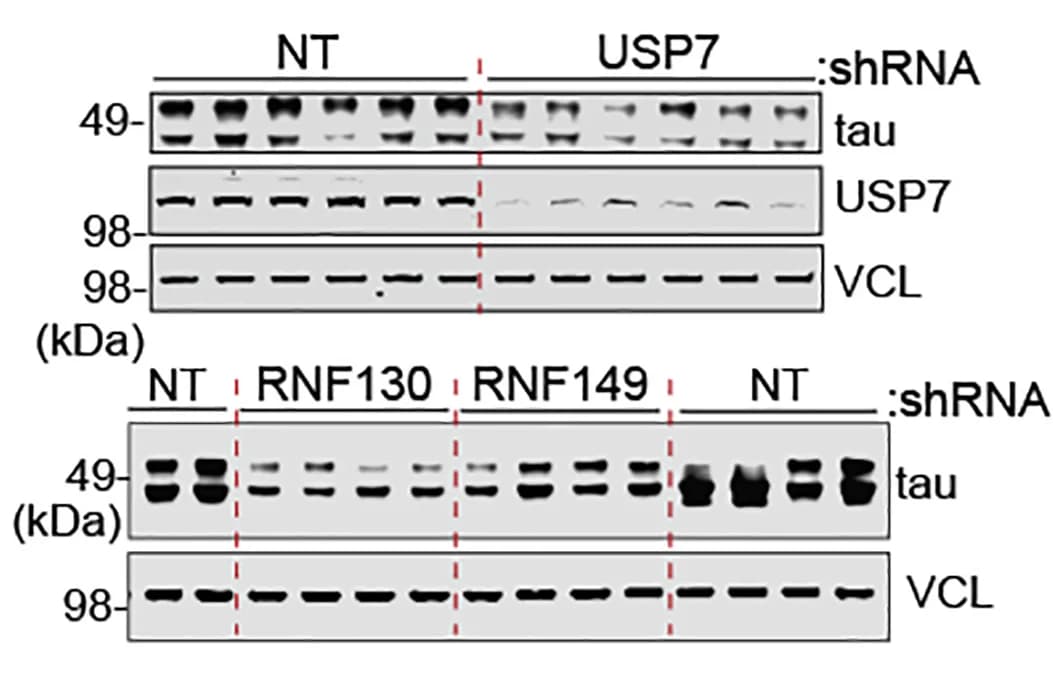 Open access visualization of Gel, Western Blot, USP7, RNF130, RNF149