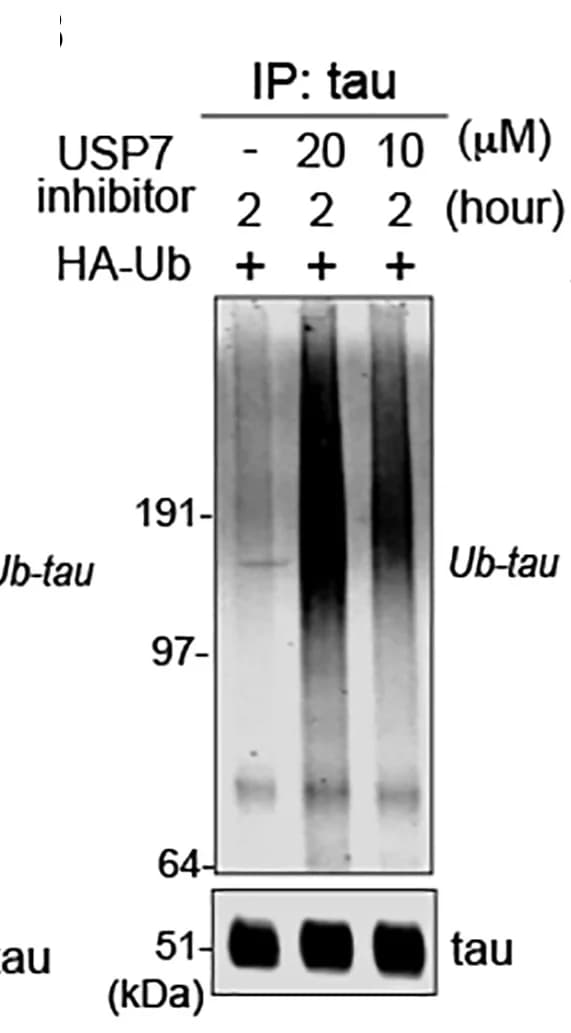 Open access visualization of Gel, Immunoblot, Tau, Polyubiquitination, USP7 inhibitor