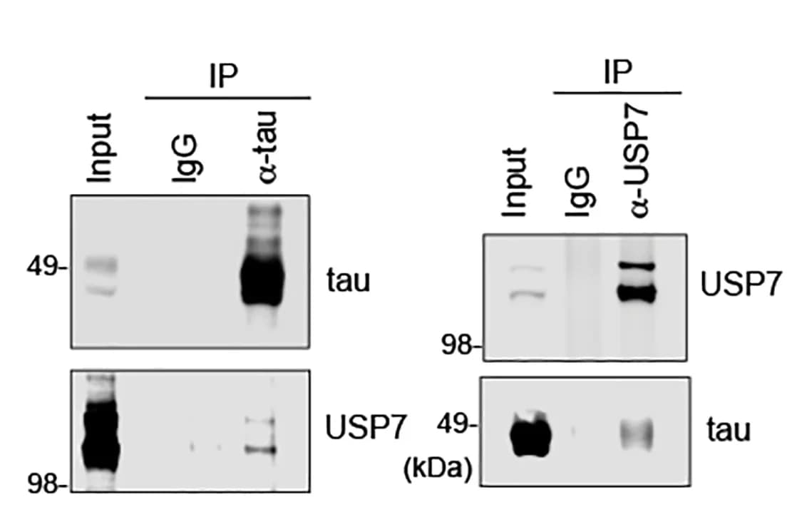 Open access visualization of Gel, Reciprocal Immunoprecipitation, Co-immunoprecipitation, Tau, CHIP Protein