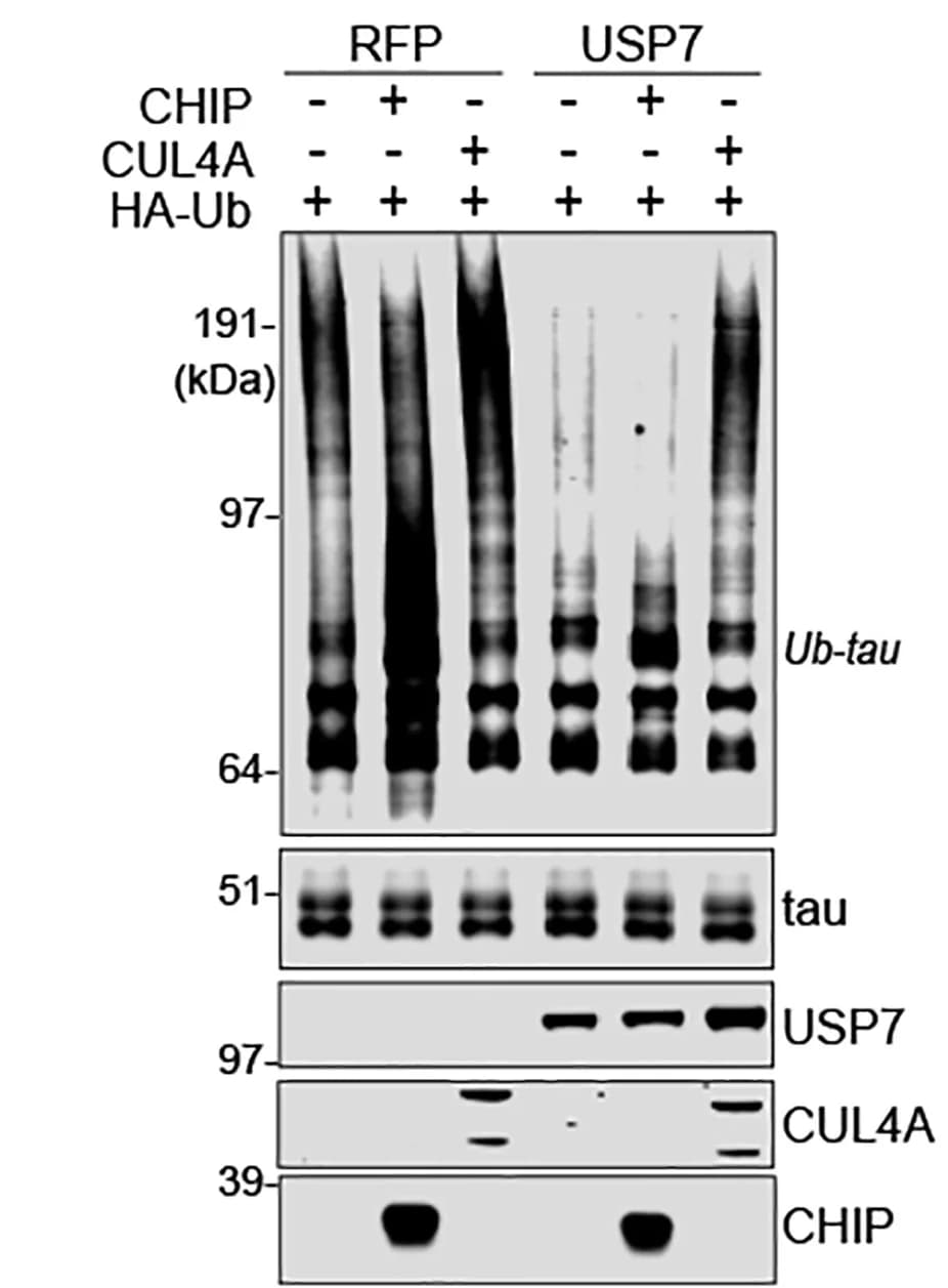 Open access visualization of Gel, Blot, Total Tau, Ubiquitinated Tau, 293T Cells