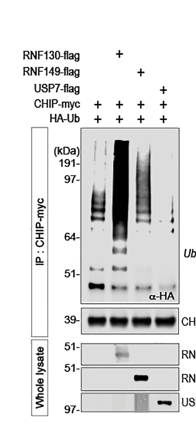 Open access visualization of Gel, IB, CHIP, Ubiquitination, RNF130