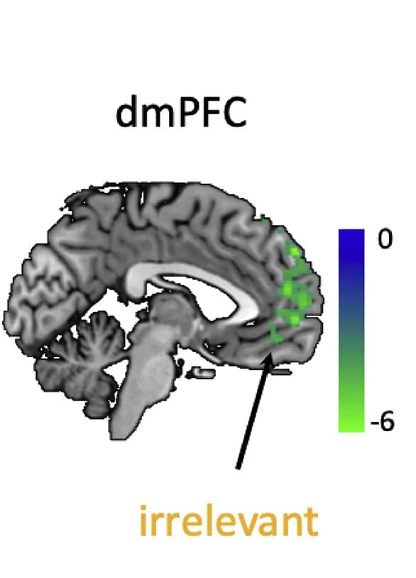 Open access visualization of Microscopy, Whole-Brain Analysis, dmPFC Activity, Character Traits