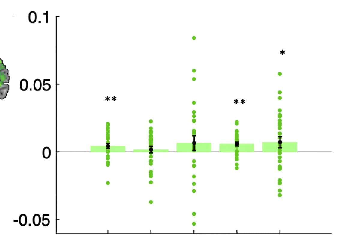 Open access visualization of Bar Plot, Error Bars, Scatter Plot, Correlations, Neural Representational Dissimilarity Matrices
