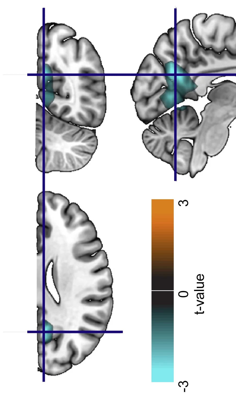 Open access visualization of Microscopy, Lateralized Gamma-Band Activity, Spectral Analysis, Phase Consistency Metric, Magnetoencephalography