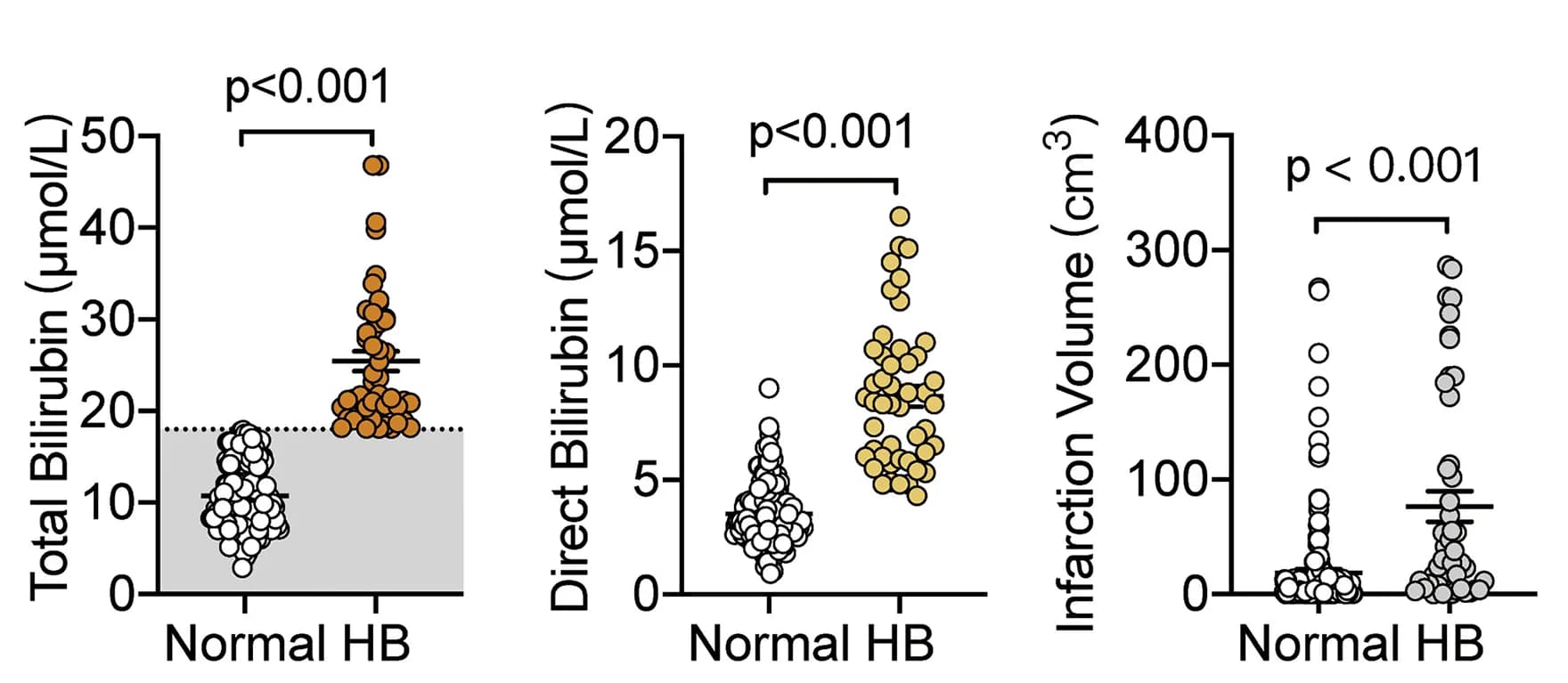 Open access visualization of Scatter Plot, TB, DB Concentration, Infarct Volumes, Stroke Patients