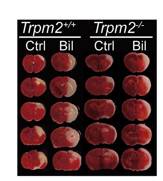 Open access visualization of Photo, Brain Sections, TTC Staining, tMCAO Mice, Saline