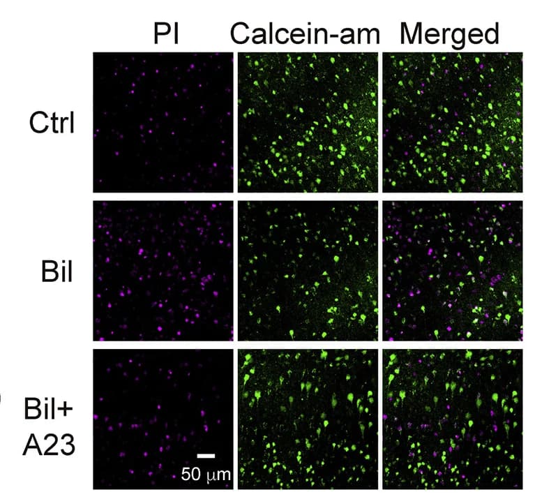 Open access visualization of Microscopy, Immunofluorescence Staining, Bilirubin, Cortical Neurons, Brain Slices
