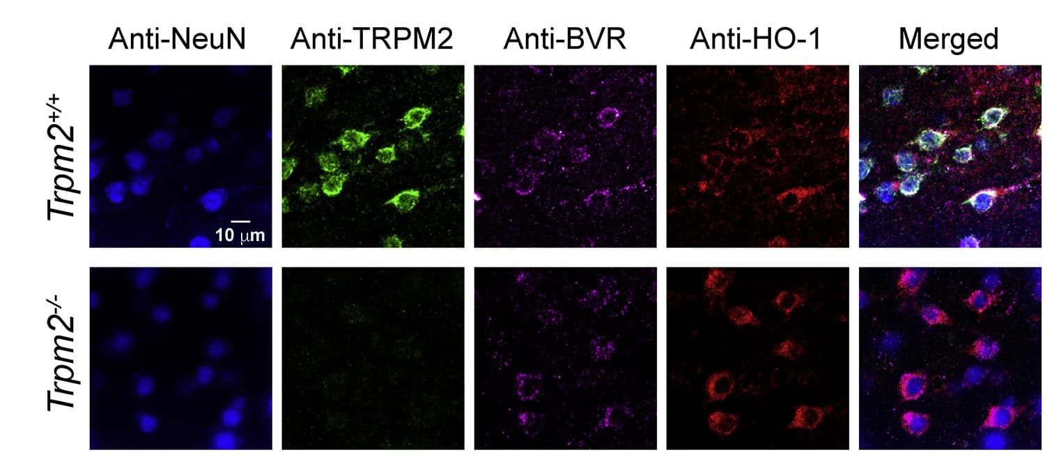 Open access visualization of Microscopy, Immunofluorescence, Neuronal, NeuN, TRPM2 Channels