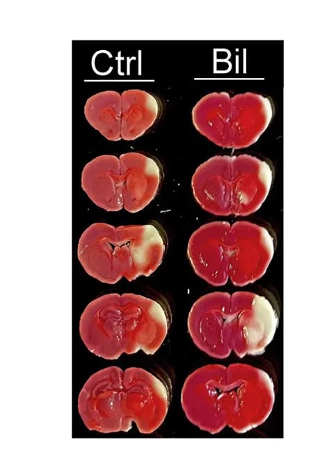 Open access visualization of Microscopy, Photo, Brain Sections, TTC Staining, D1066AKI Mice