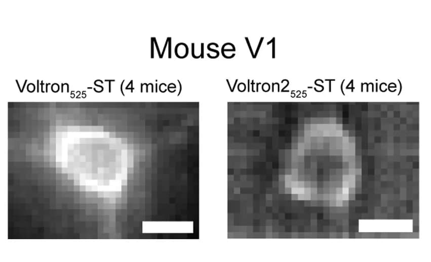 Open access visualization of Microscopy, Cortical Pyramidal Neurons, Voltron525-ST, Voltron2525-ST, Image