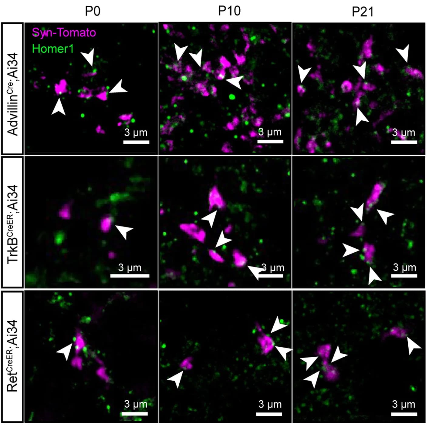 Open access visualization of Microscopy, Immunohistochemistry, Spinal Cord, Dorsal Horn, Synapses