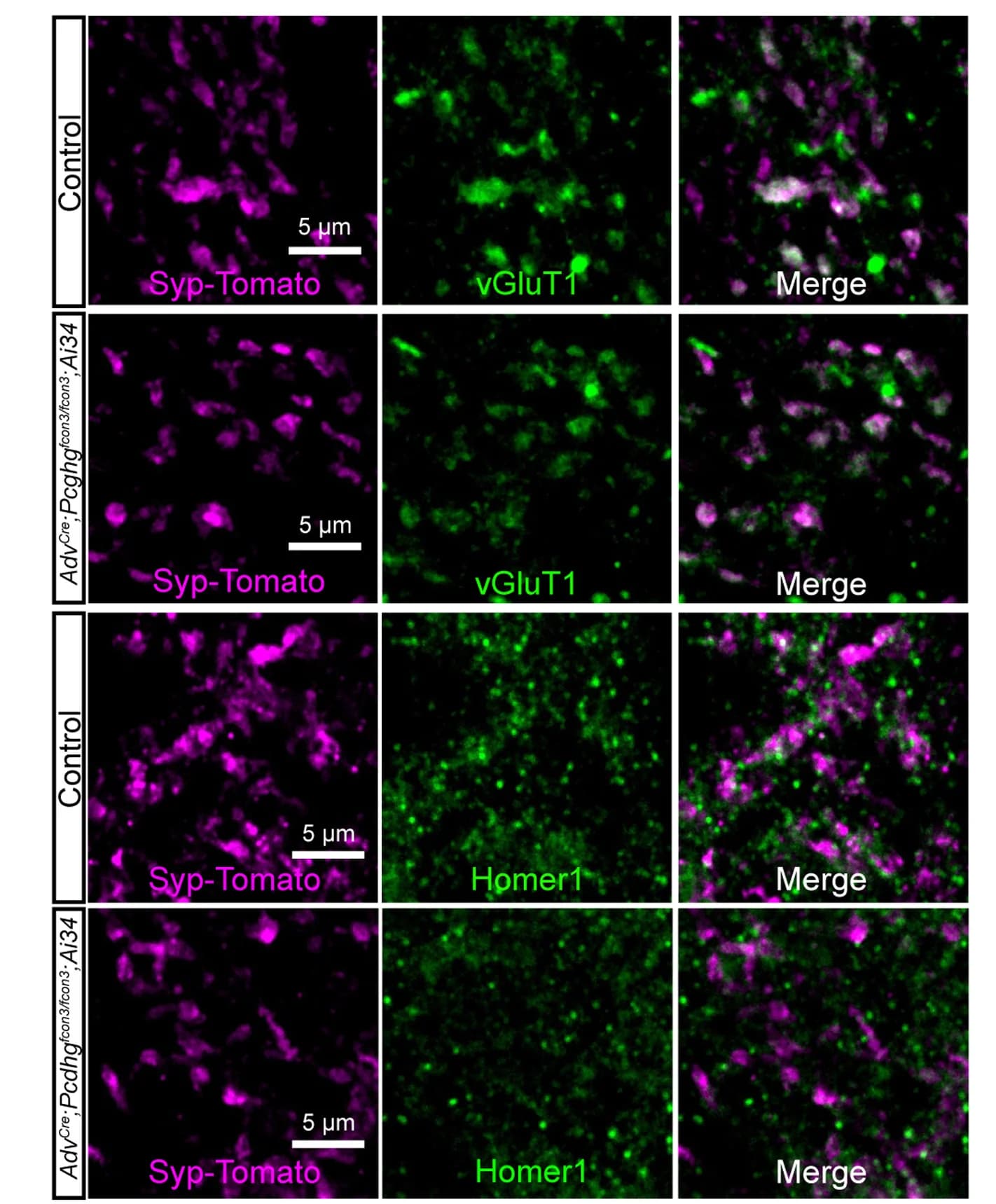 Open access visualization of Microscopy, IHC Images, Spinal Cord, Lamina III, P21