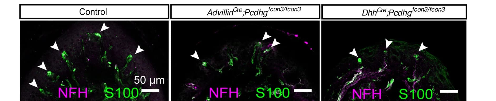 Open access visualization of Microscopy, Immunostaining, Skin, Meissner Corpuscles, Lamellar Cells