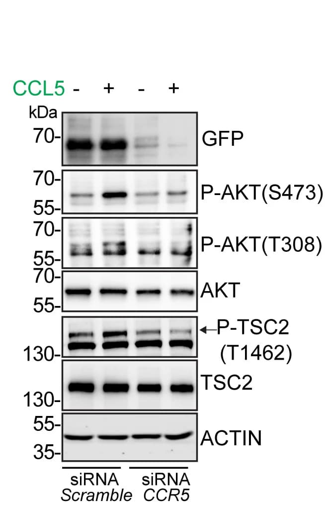Open access visualization of Gel, Western Blotting, P-AKT, AKT, P-TSC2