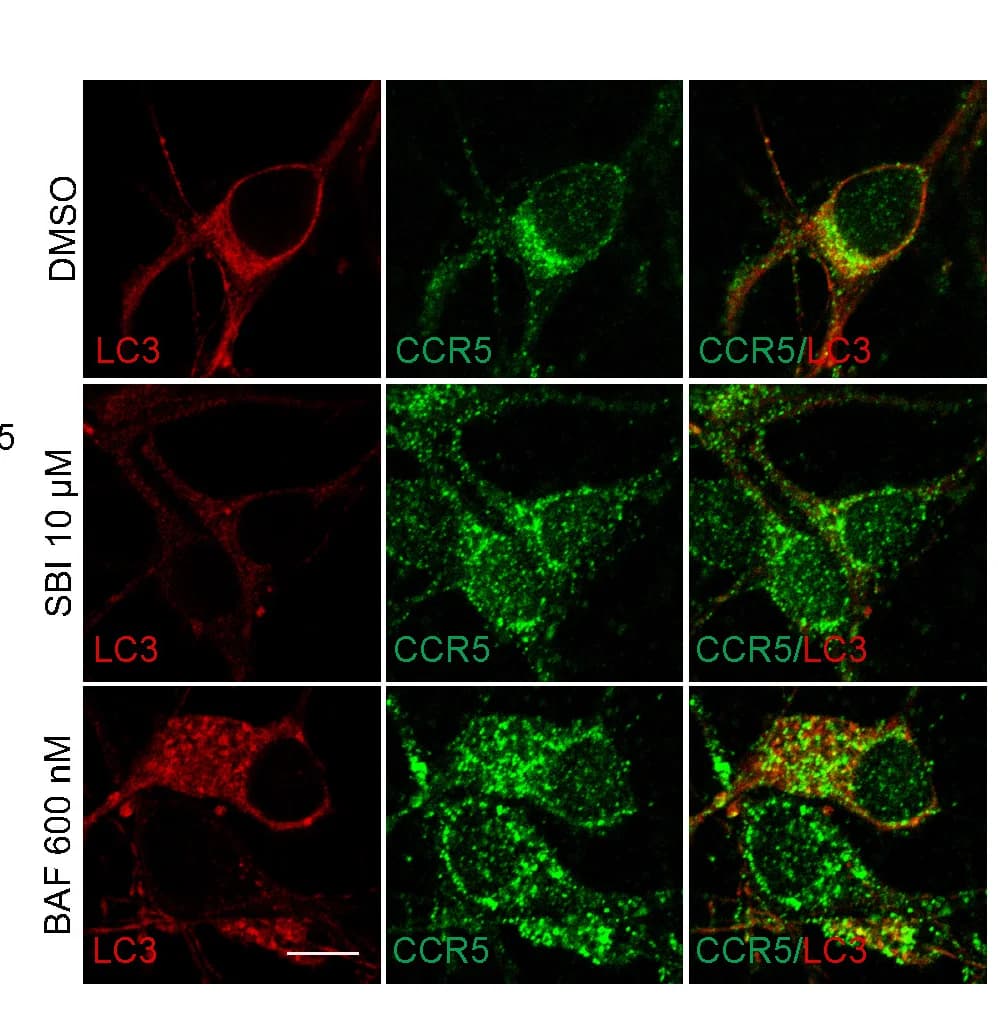 Open access visualization of Microscopy, Confocal Micrographs, CCR5, LC3, Mouse Primary Neurons