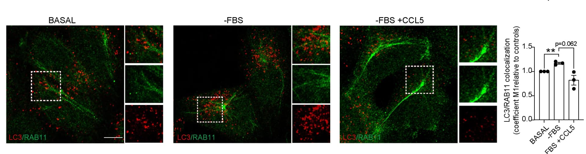 Open access visualization of Microscopy, Bar Plot, Error Bars, HeLa Cells, FBS-depleted media