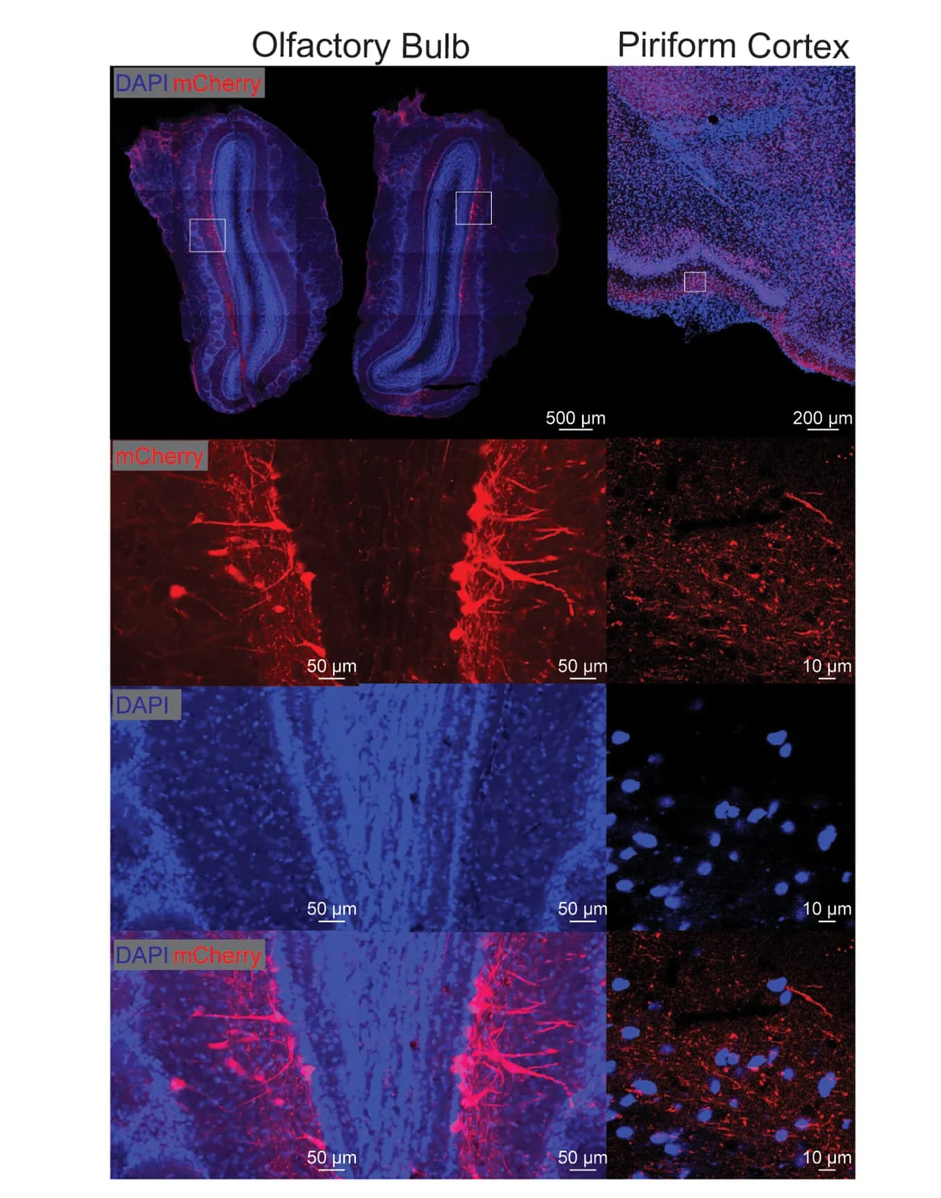 Open access visualization of Microscopy, Fluorescent Images, mCherry Expression, Neurons, Axonal Projections