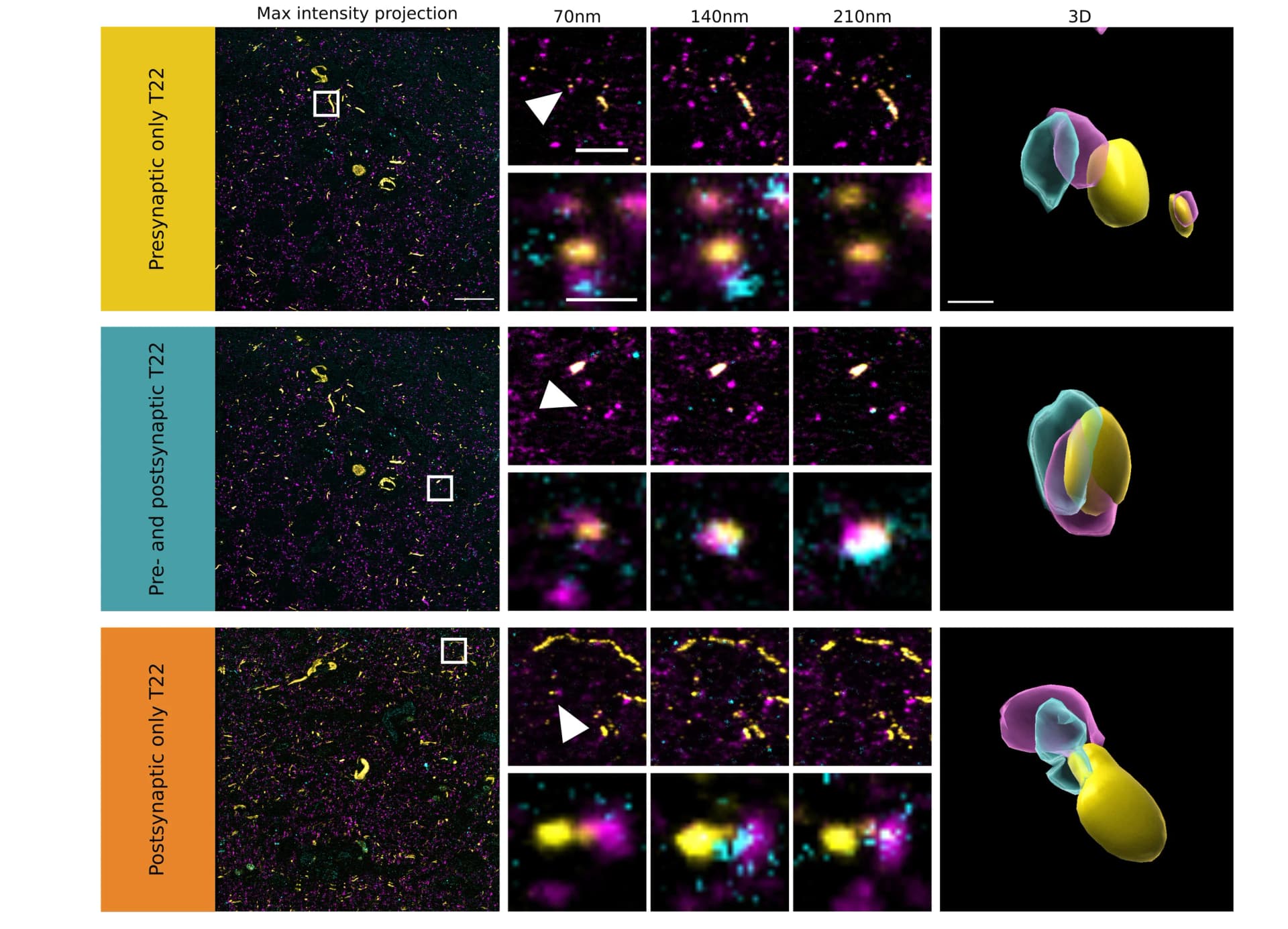 Open access visualization of Microscopy, 3D Plot, Array Tomography, Synaptic Terminals, Oligomeric Tau
