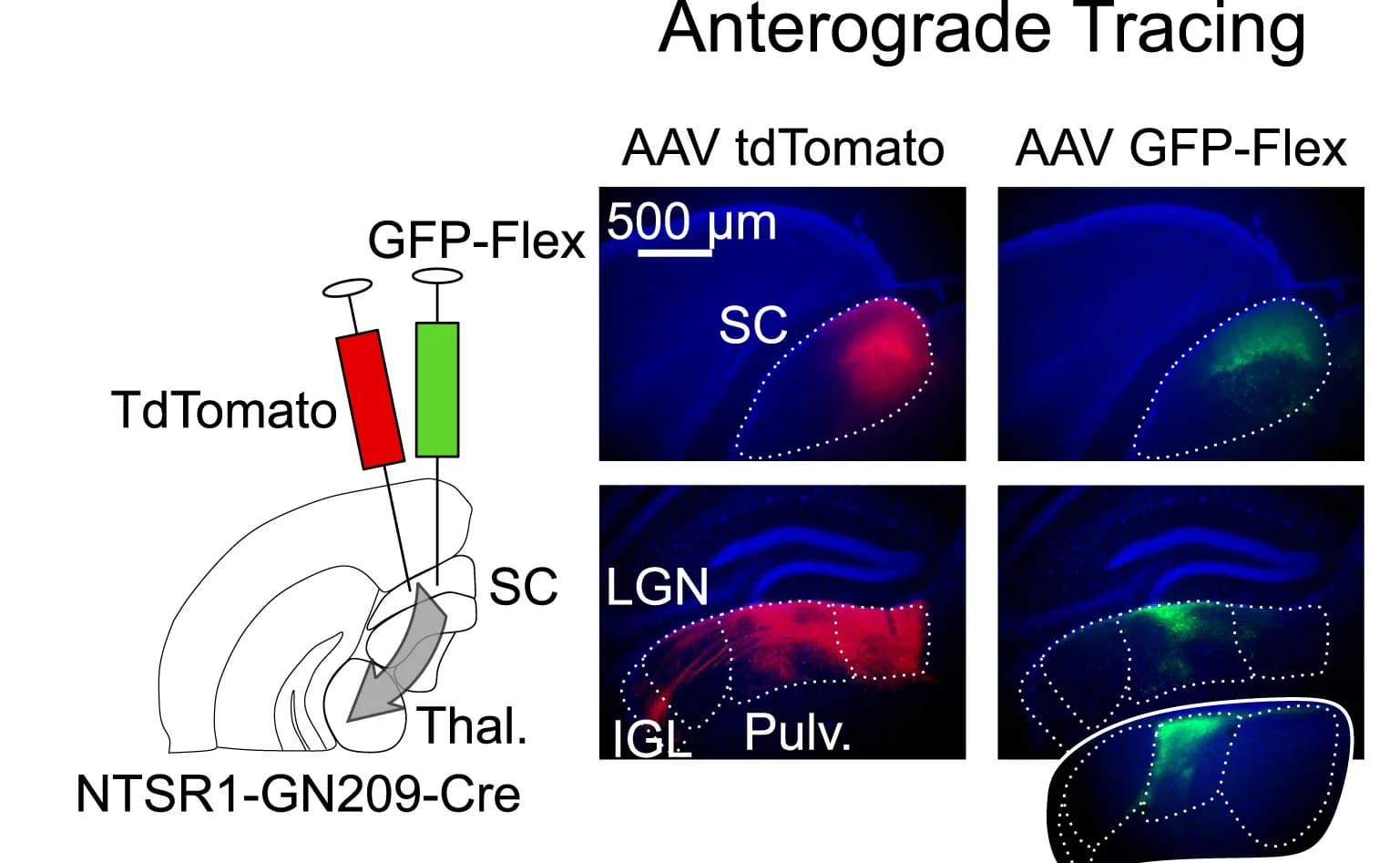 Open access visualization of Microscopy, Illustration, Anterograde Tracing, AAV-tdTomato, AAV-GFP-flex