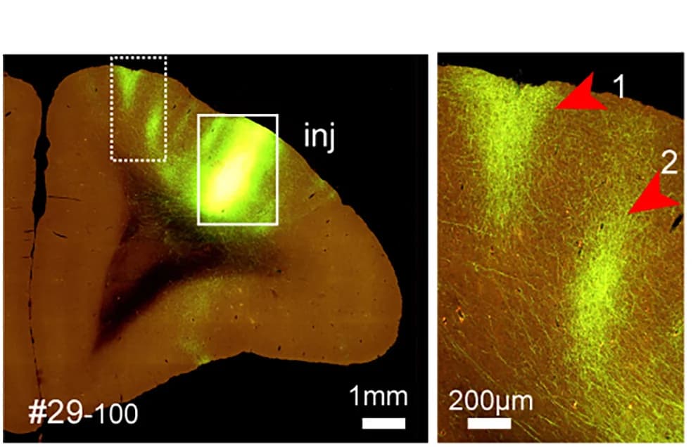 Open access visualization of Microscopy, Section Image, Injection Site, AAV Transduced Cells