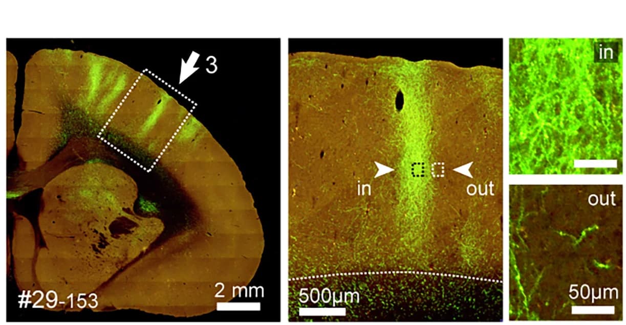 Open access visualization of Microscopy, Columnar Axonal Convergence, Section