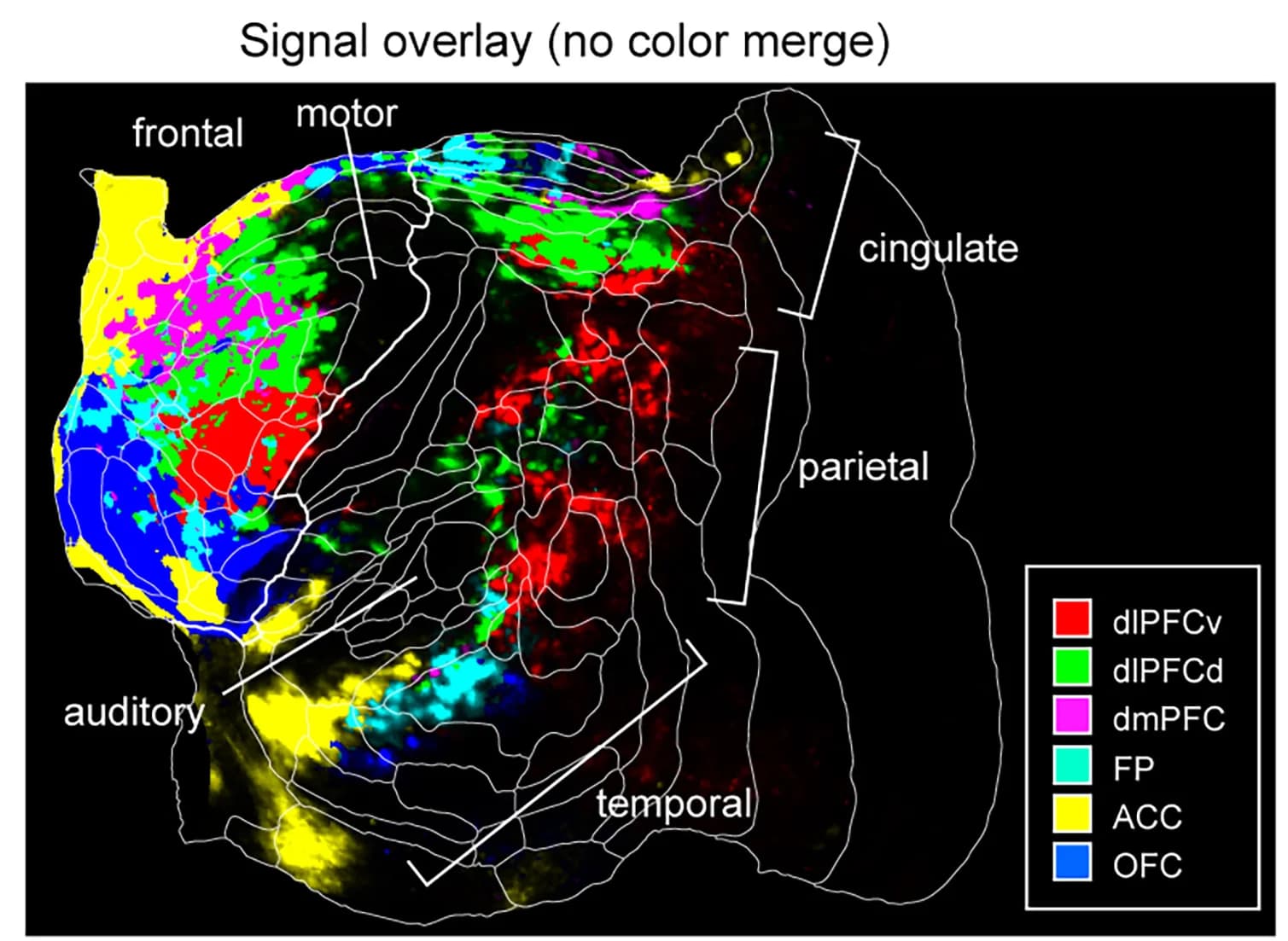 Open access visualization of Microscopy, Overlay Image, Projections, Distribution Pattern, Dorsolateral PFC Dorsal