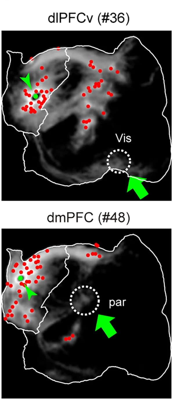 Open access visualization of Scatter Plot, Microscopy, Tracer Images, Columnar Patches, Parietal Area