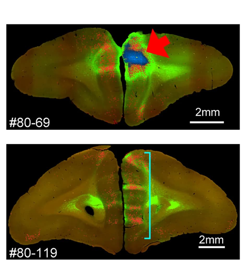 Open access visualization of Microscopy, Anterograde Tracers, Retrograde Tracers, Colocalization, Cell Nuclei