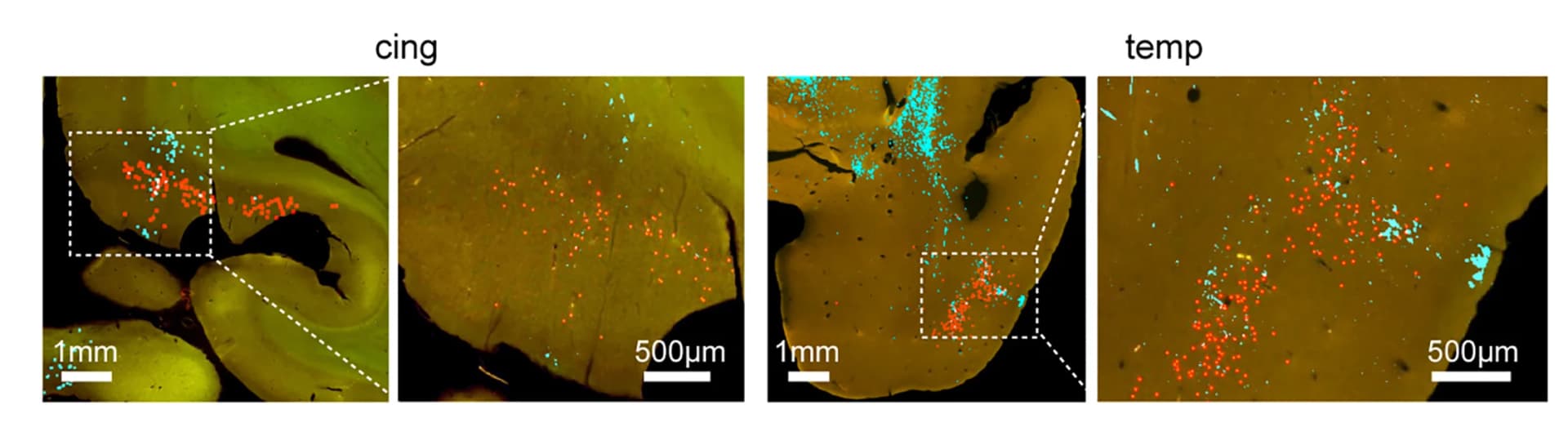 Open access visualization of Microscopy, Colocalization, Anterograde Signals, Retrograde Signals, Cingulate Region