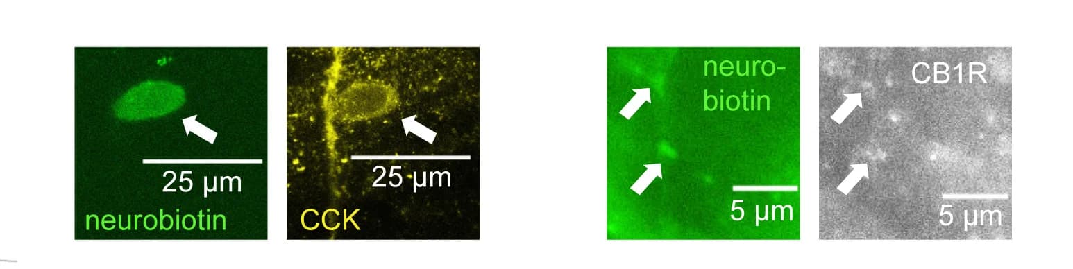 Open access visualization of Microscopy, Neurobiotin, Soma, TF107b1, CCK+