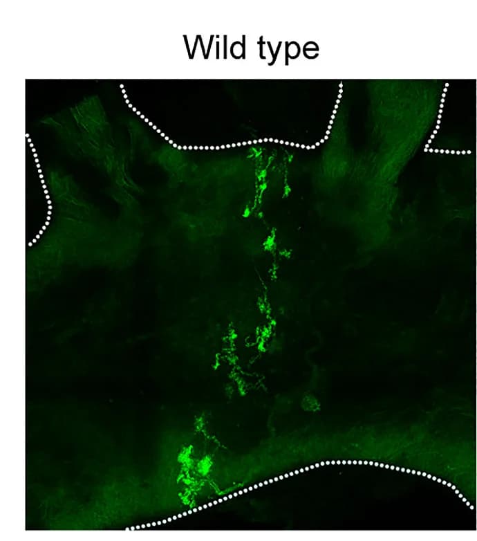 Open access visualization of Microscopy, FM 1-43 Labeling, Aorta Baroreceptor Endings, Wild-Type Mice, Whole-Mount