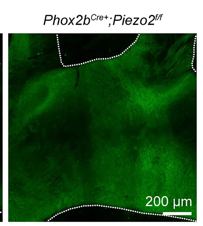 Open access visualization of Microscopy, Phox2bCre+;Piezo2f/fKO Mice, Aorta Baroreceptor Endings, FM 1-43 Labeling