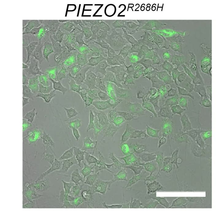 Open access visualization of Microscopy, HEK Cells, PIEZO2R2868H, Gain-of-function Allele, No Stimulus
