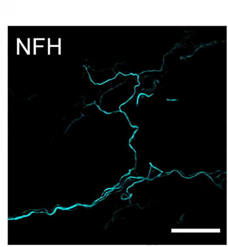 Open access visualization of Microscopy, FM 1-43 labeling, Immunostaining, Urethral ending, WT animal