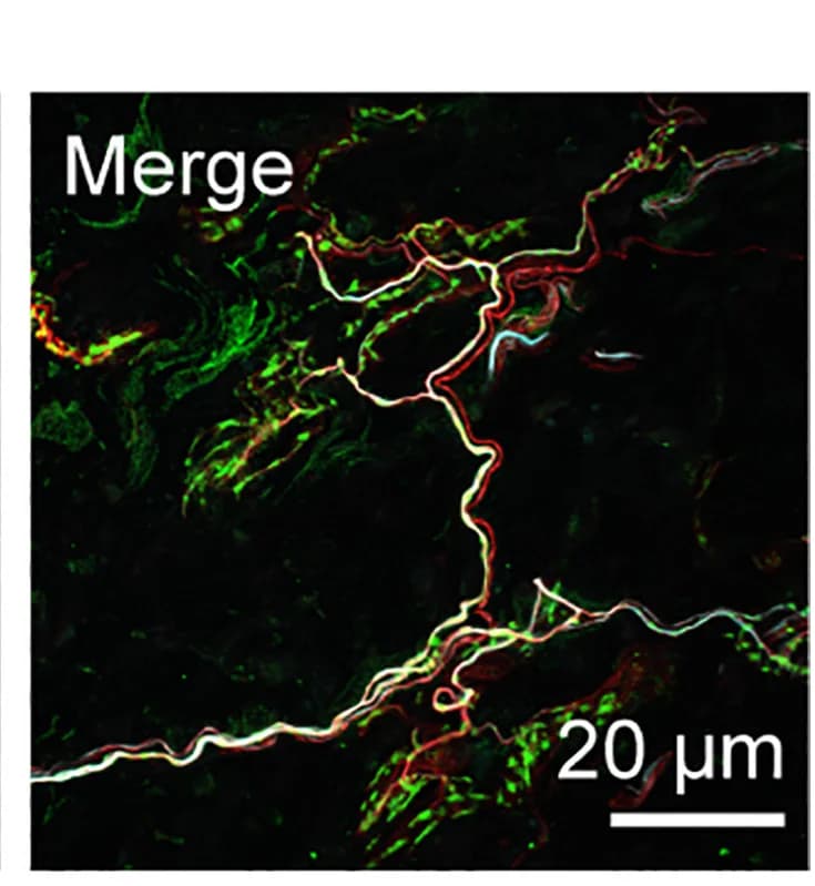 Open access visualization of Microscopy, FM 1-43 labeling, Immunostaining, Urethral ending, WT animal
