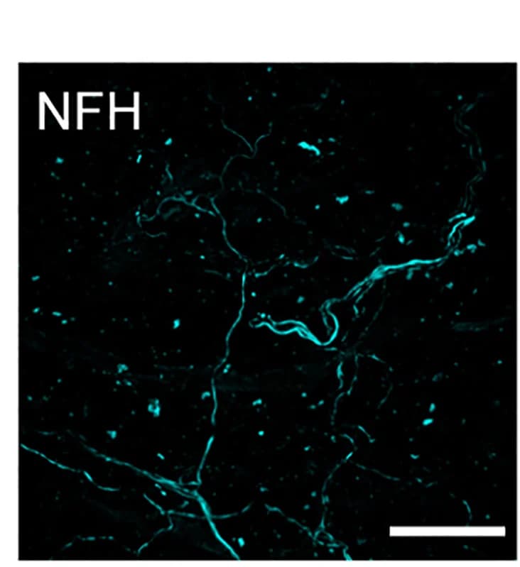Open access visualization of Microscopy, FM 1-43 labeling, Immunostaining, Urethral ending, HoxB8Cre+;Piezo2f/fKO animal