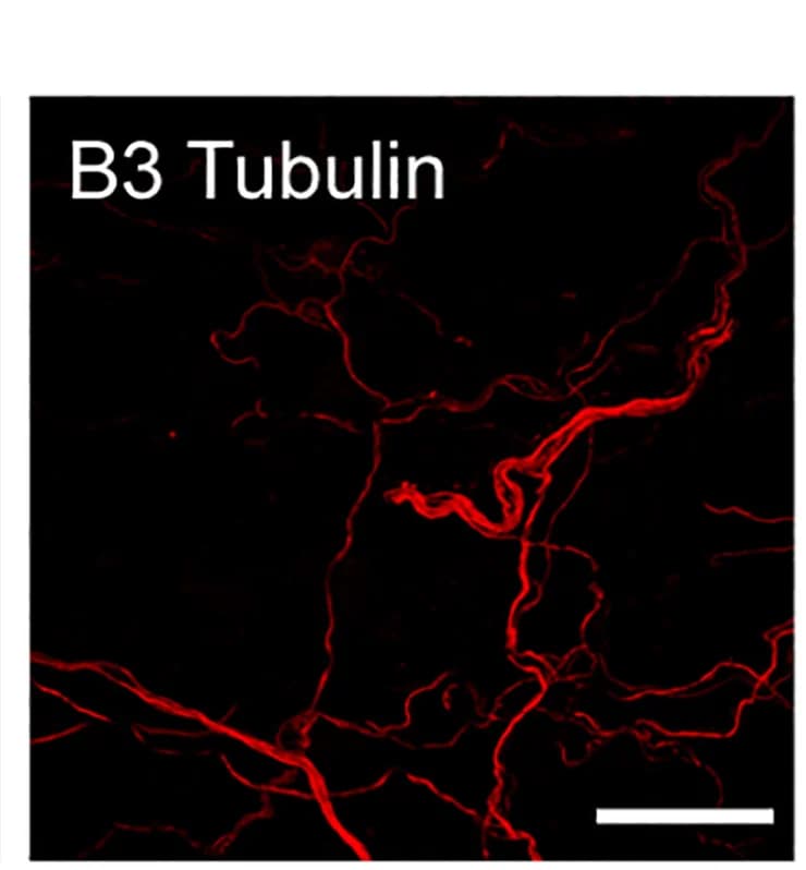 Open access visualization of Microscopy, FM 1-43 labeling, Immunostaining, Urethral ending, HoxB8Cre+;Piezo2f/fKO animal
