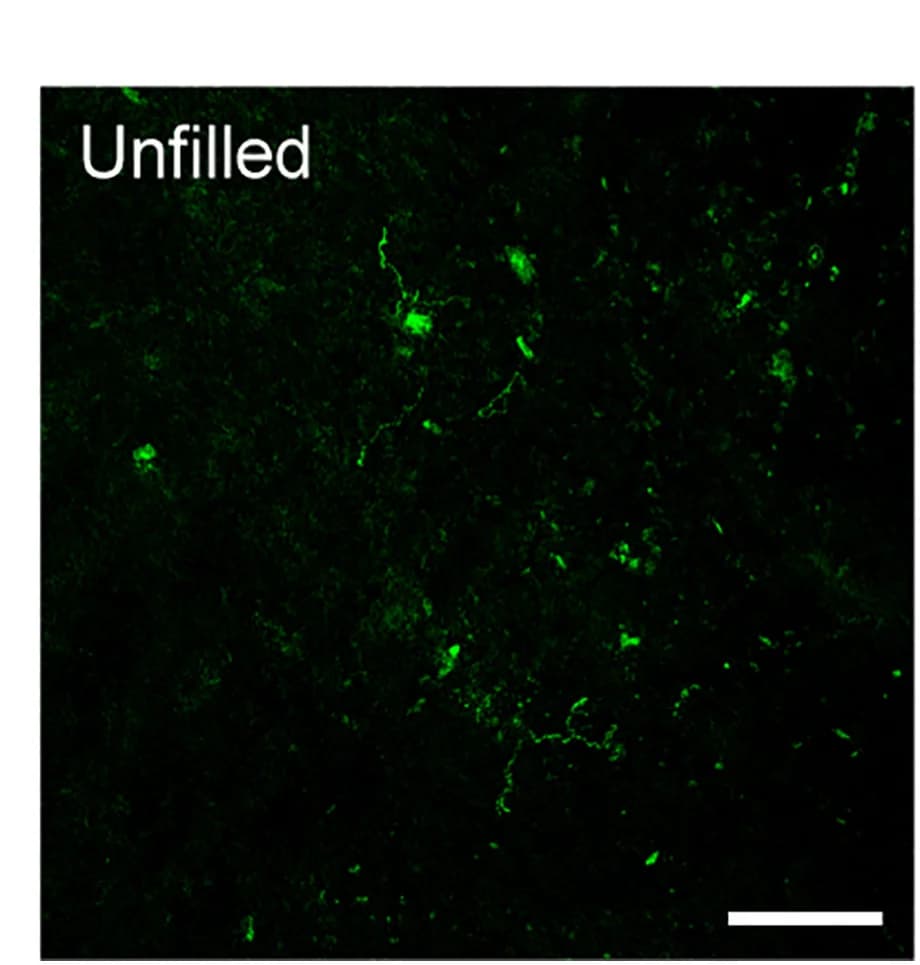 Open access visualization of Microscopy, FM 1-43 labeling, Pelvic urethra, Unfilled bladder