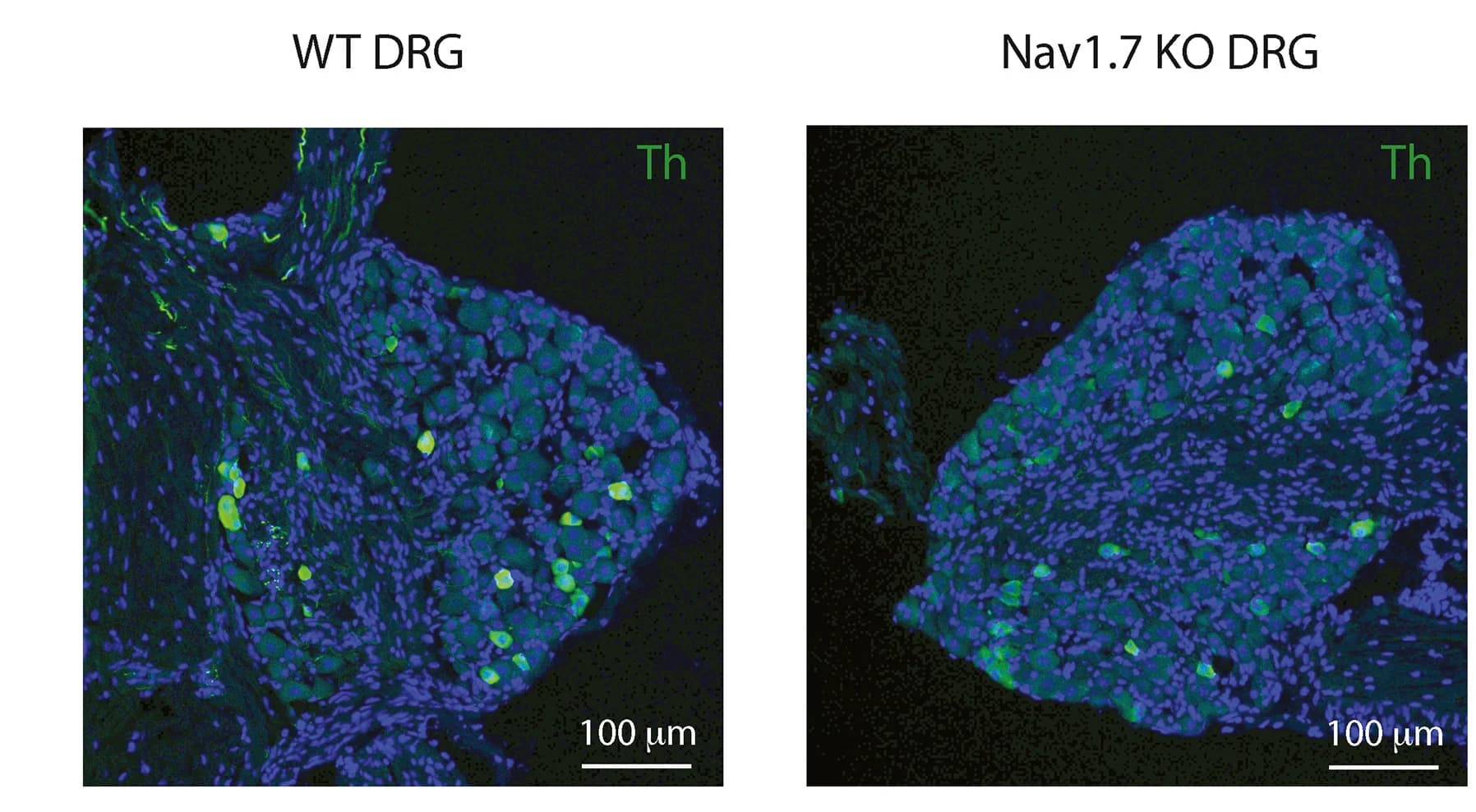 Open access visualization of Microscopy, Immunohistochemical Staining, Tyrosine Hydroxylase, DRGs, Nav1.7 KO
