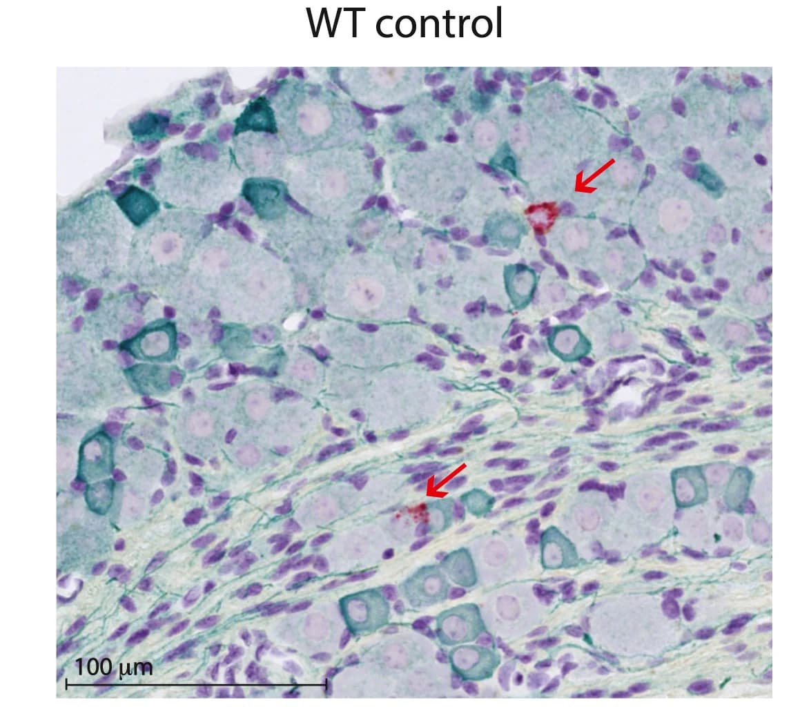 Open access visualization of Microscopy, ISH, WT DRG, Penkin, DRG Neurons