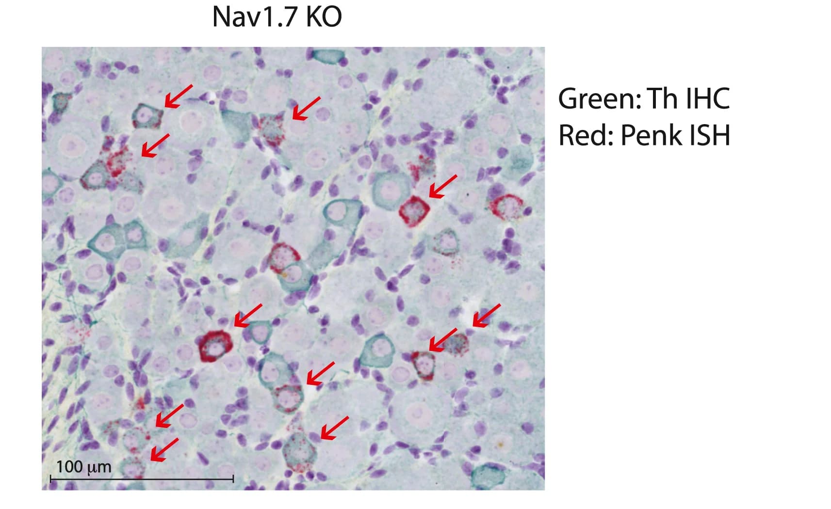 Open access visualization of Microscopy, ISH, Nav1.7 KO DRGs, Penkin, DRG Neurons