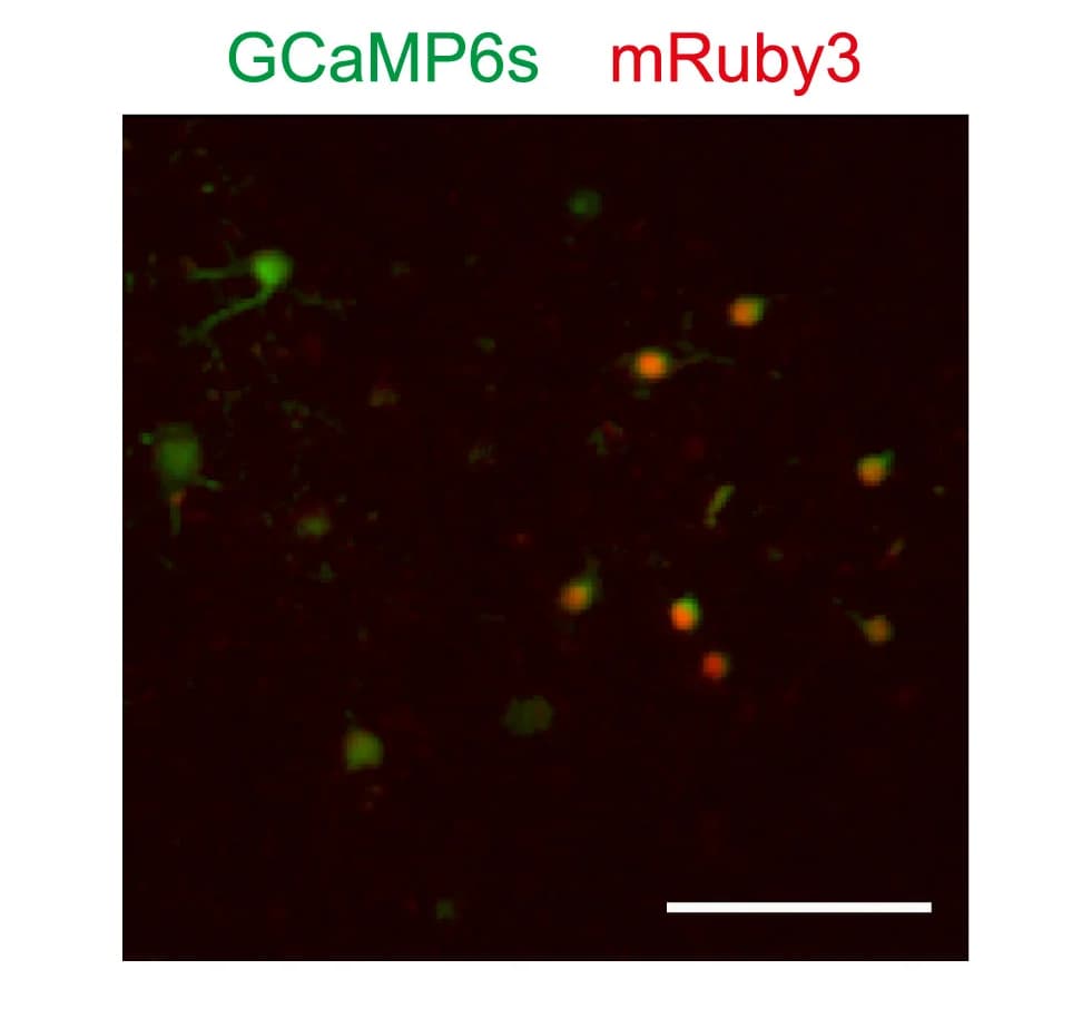 Open access visualization of Microscopy, Field of View, VIP INs, GCaMP6s, mRuby3-2A-dCre