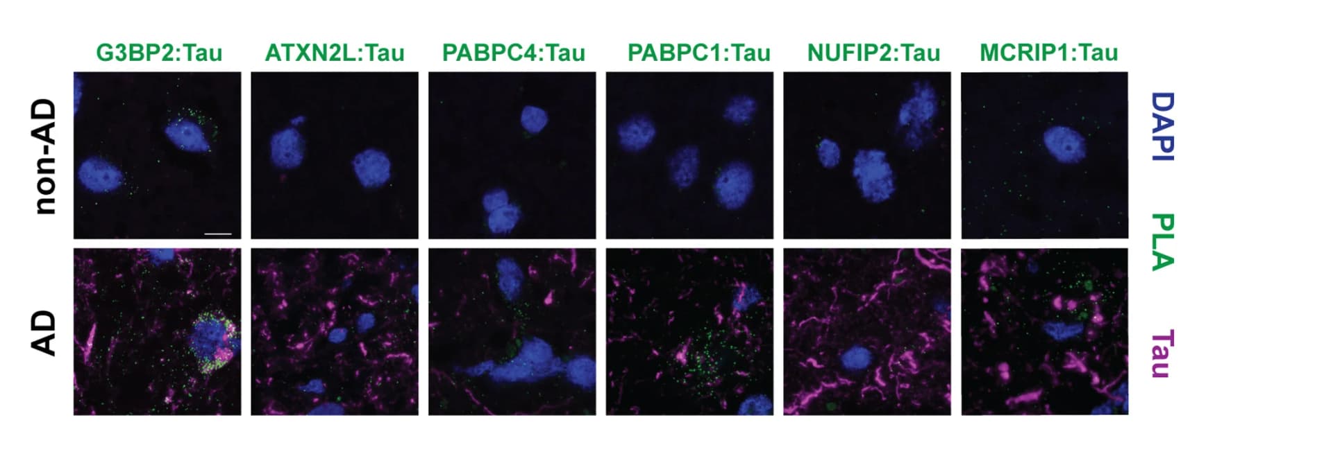 Open access visualization of Microscopy, Confocal images, PLA, Tau, Temporal cortex