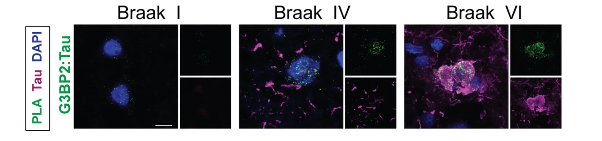 Open access visualization of Microscopy, PLA Signals, Tau Signals, AD, Braak Stages