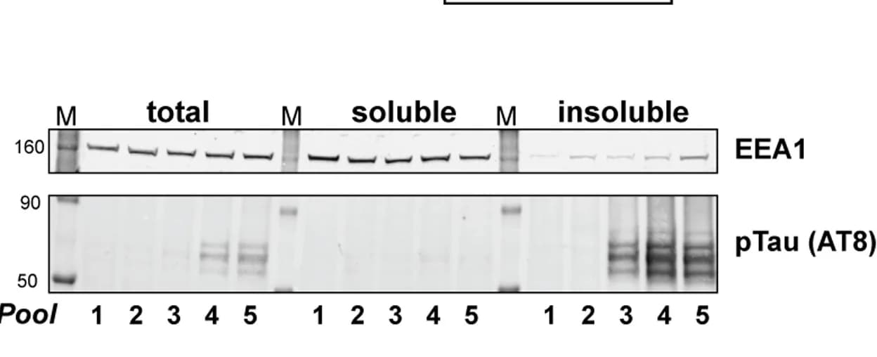 Open access visualization of Gel, Fractionation, Immunoblotting, pTau, EEA1