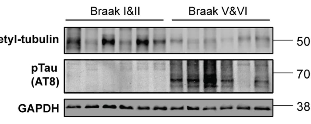 Open access visualization of Gel, Immunoblot, Brain Homogenates, GAPDH, Loading Control