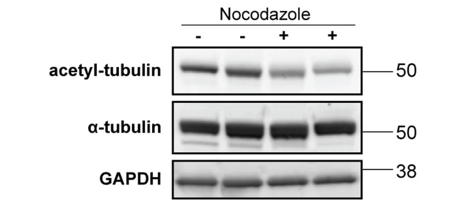 Open access visualization of Gel, Immunoblot, Human Neuron Lysates, GAPDH, Loading Control