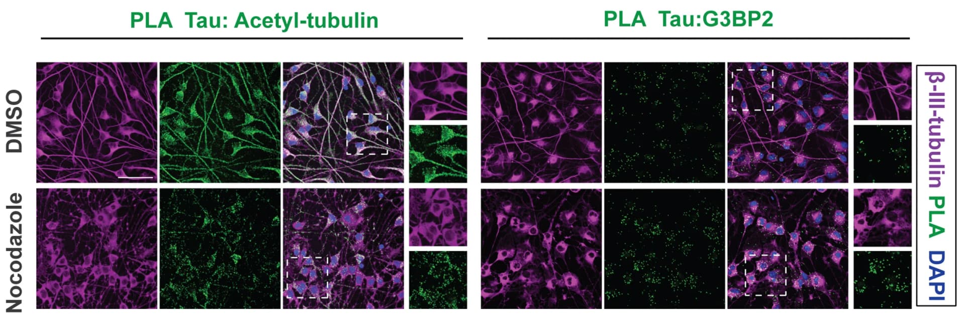 Open access visualization of Microscopy, PLA Staining, beta-III-tubulin, hiPSC-derived Neurons, Nocodazole